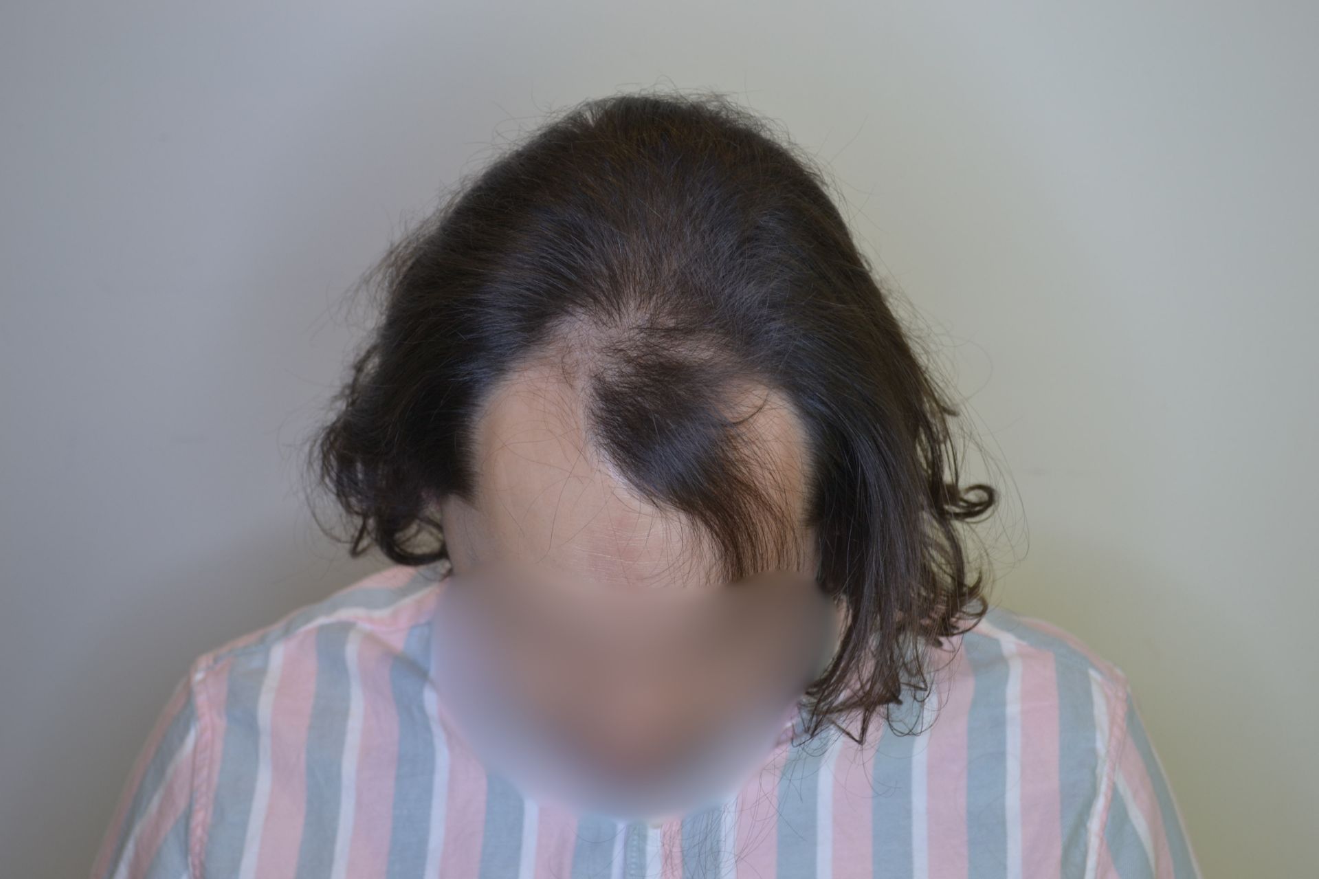 Antes