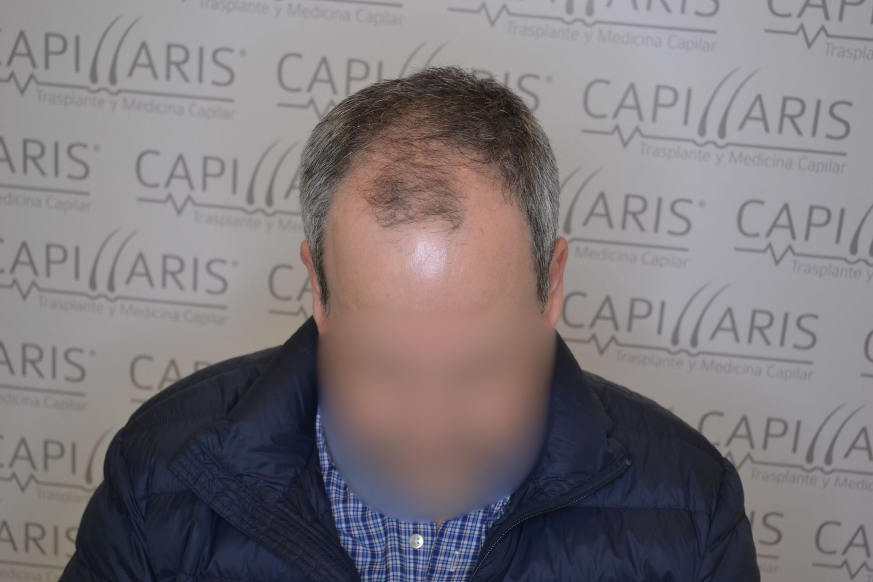 Antes