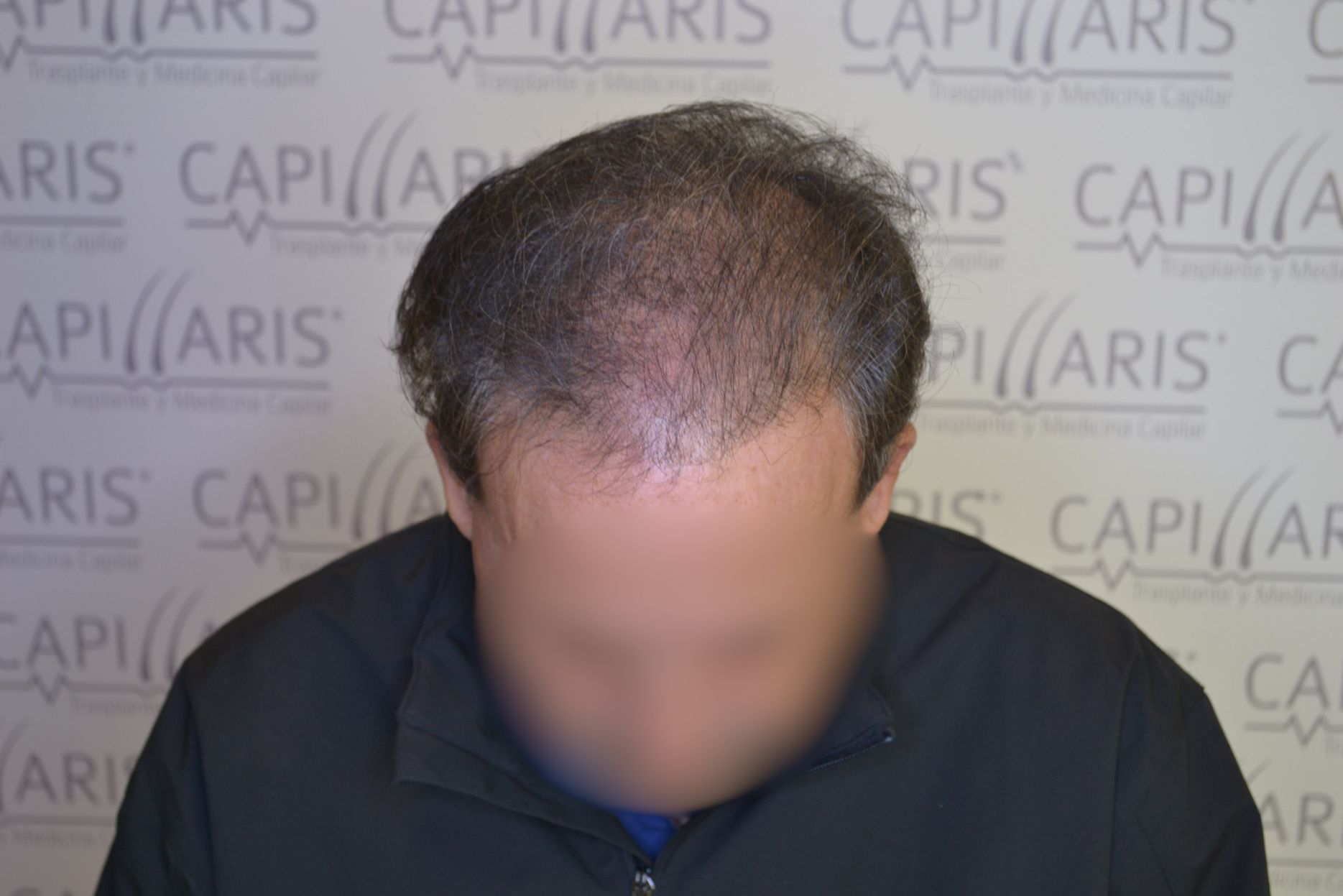 Antes