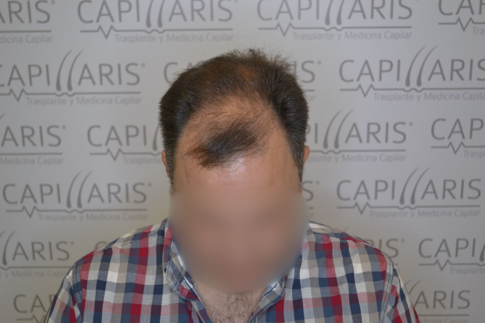 Antes
