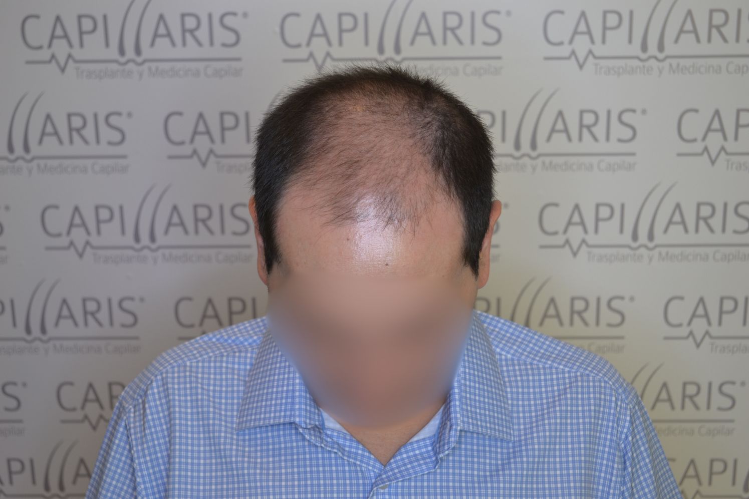 Antes
