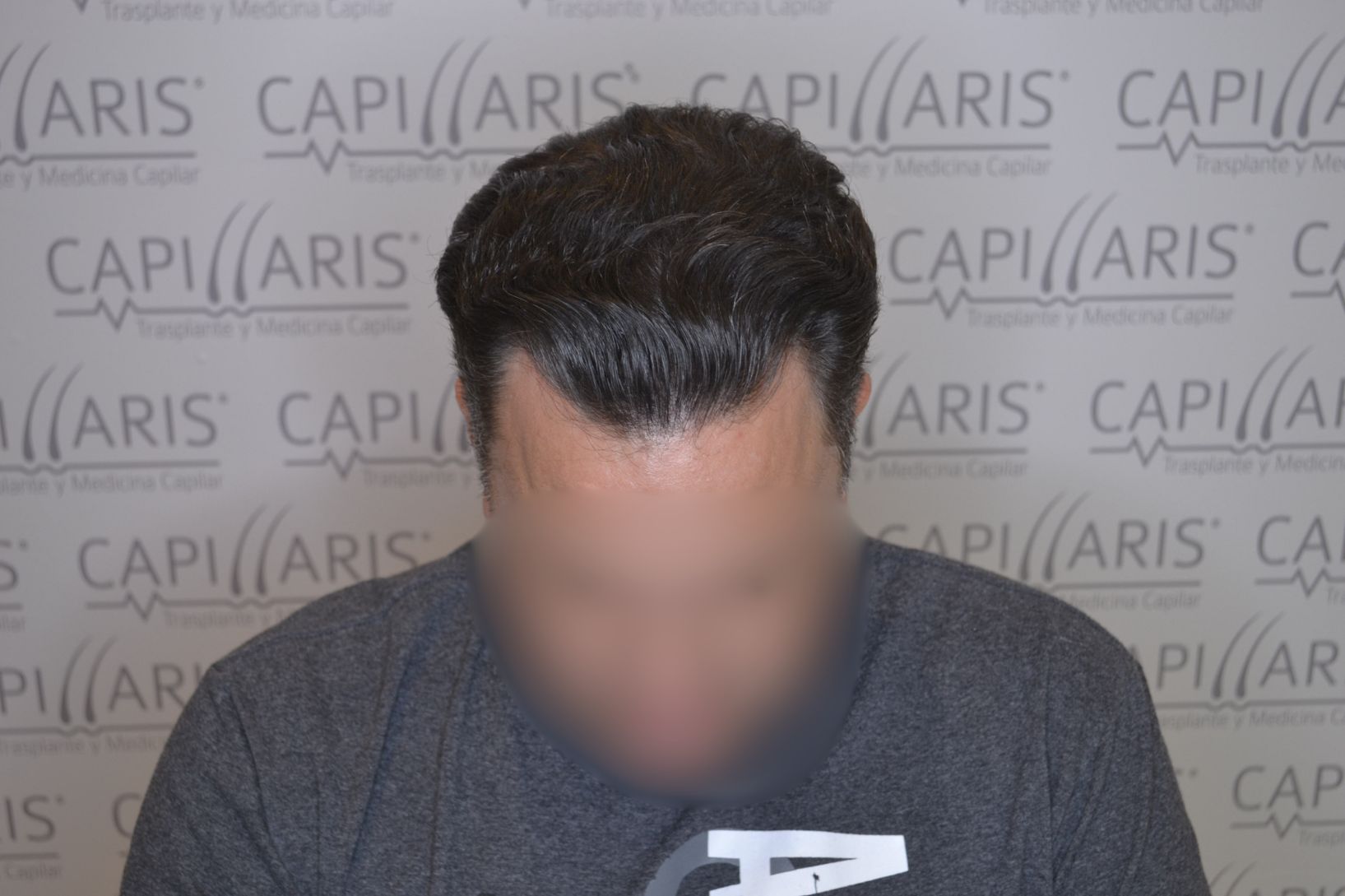 Después