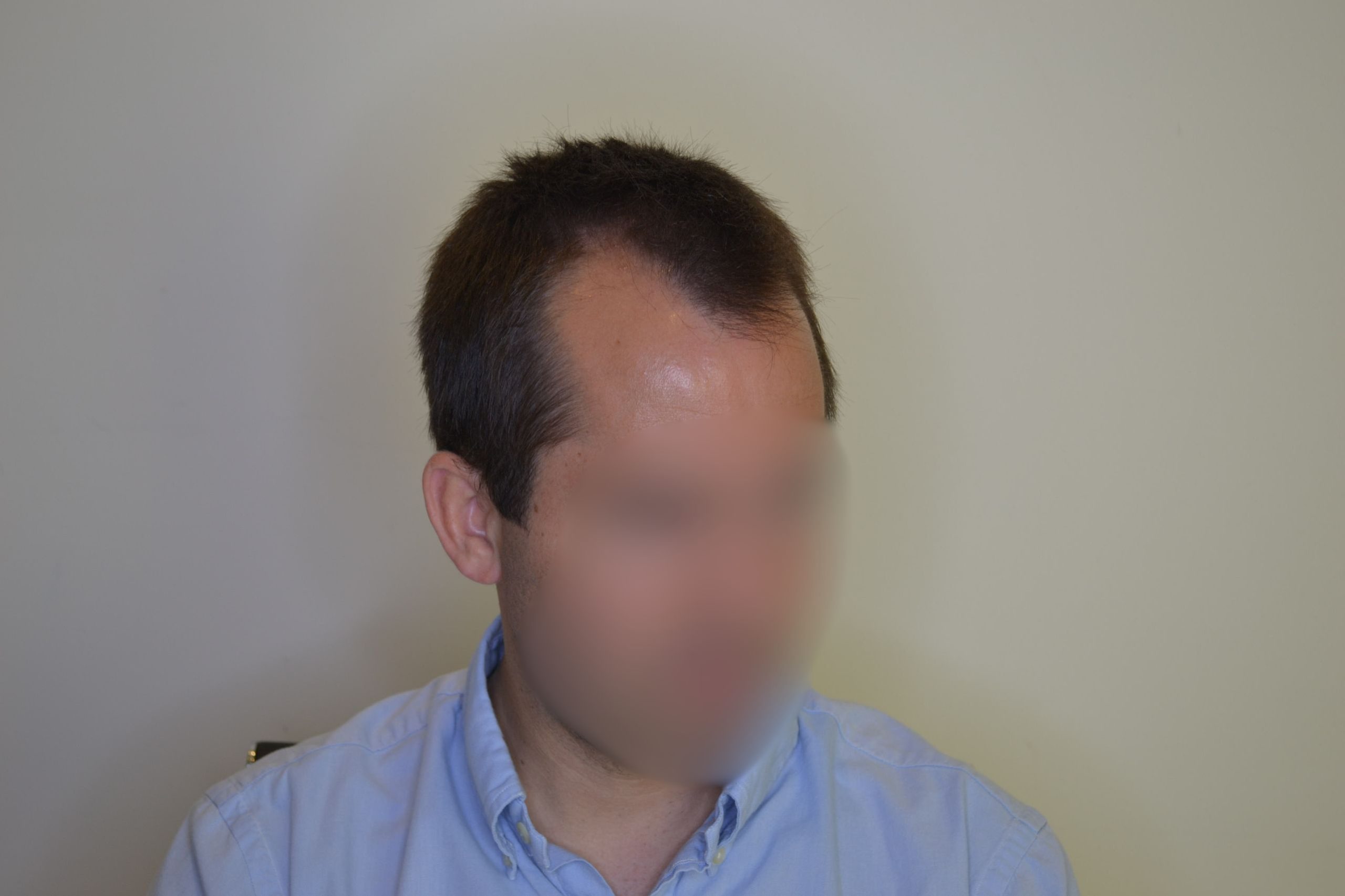 Antes