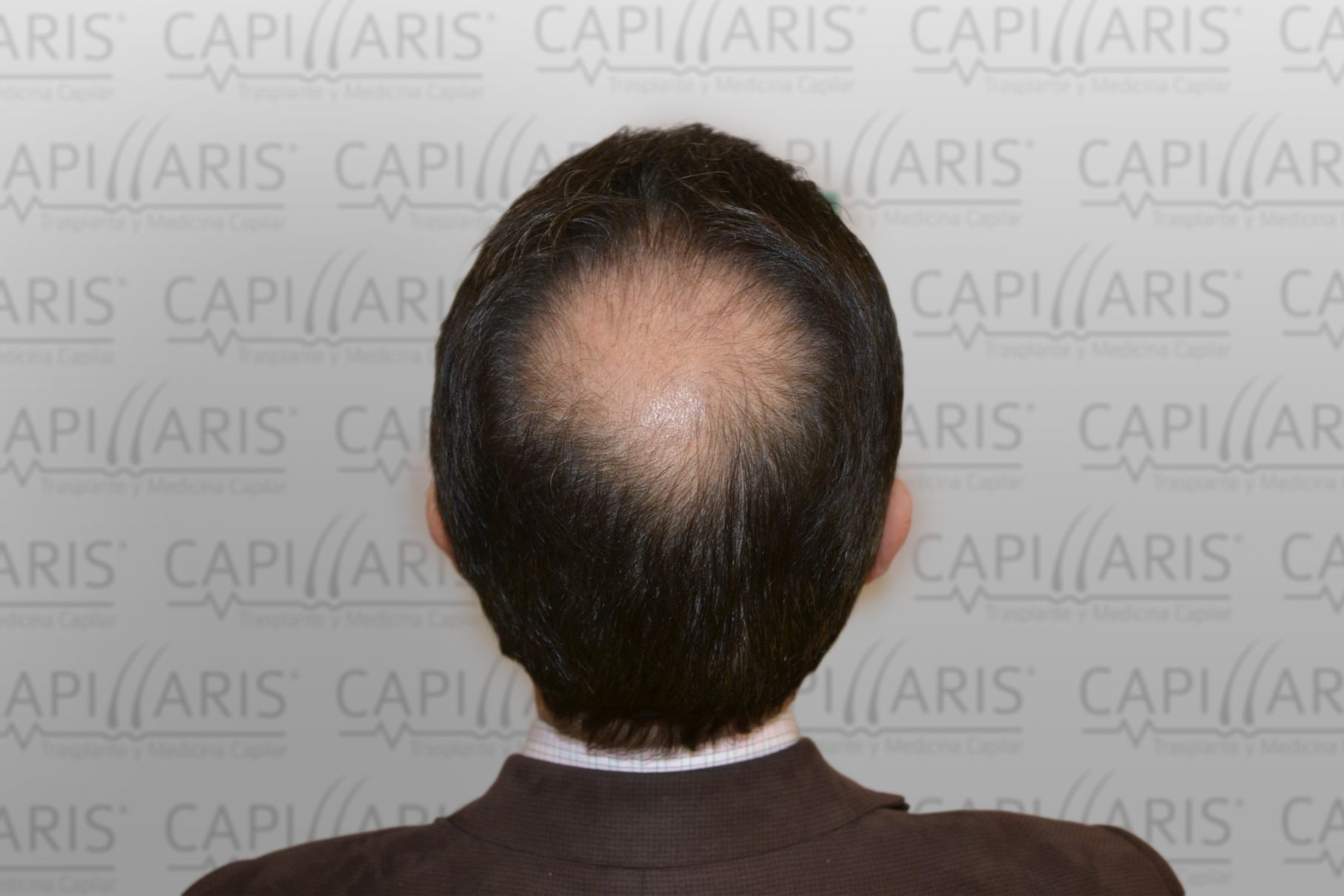 Antes